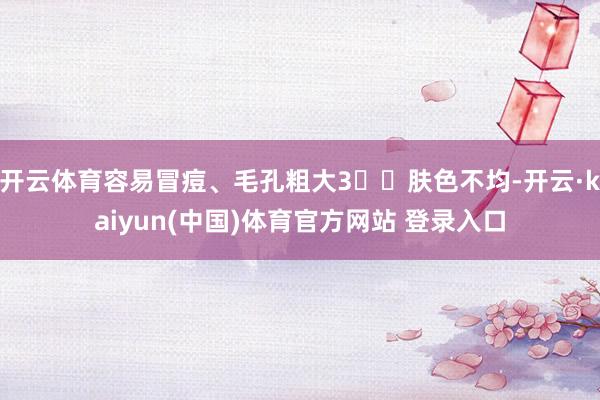 开云体育容易冒痘、毛孔粗大3️⃣肤色不均-开云·kaiyun(中国)体育官方网站 登录入口
